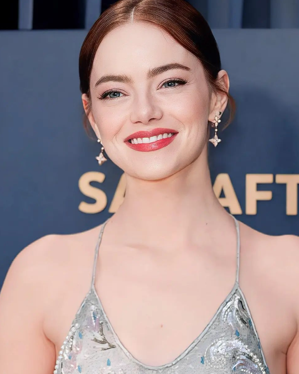 Emma Stone tregon detaje të reja nga kostumografia e filmit “Poor Things”